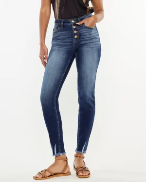 High Rise Ankle Skinny Jeans - Dark Wash
